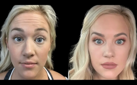 How to Prepare for Your Botox in Dubai Appointment: A Step-by-Step Guide