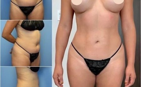 How Body Contouring in Dubai Creates Beautiful, Defined Curves