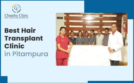 How Long Will It Take to Get Results With Hair Transplant?