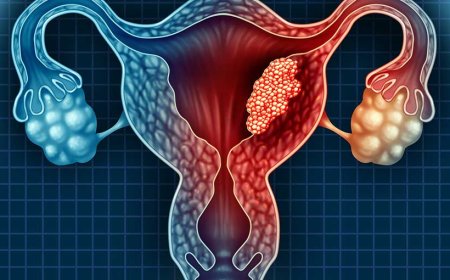 What Is Endometrial Cancer?