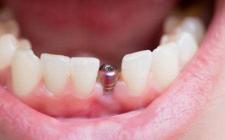 How Local Clinics Are Restoring Smiles in Chesterfield