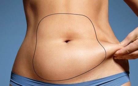 Liposuction Surgery in Dubai Your Journey to a Body Transformation