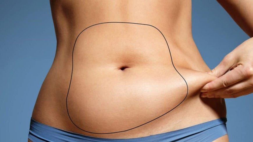 Liposuction Surgery in Dubai Your Journey to a Body Transformation